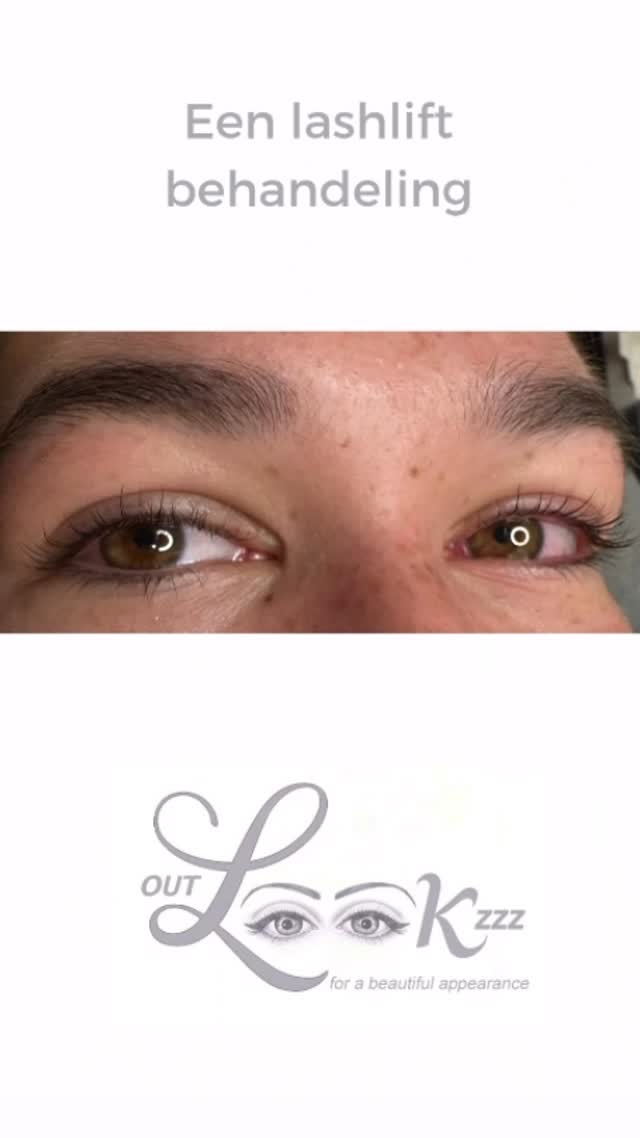 Wimperbehandeling resultaat